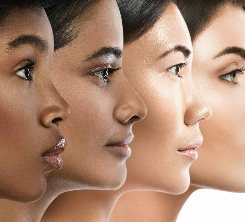 Vier Frauen mit verschiedenen Hauttypen